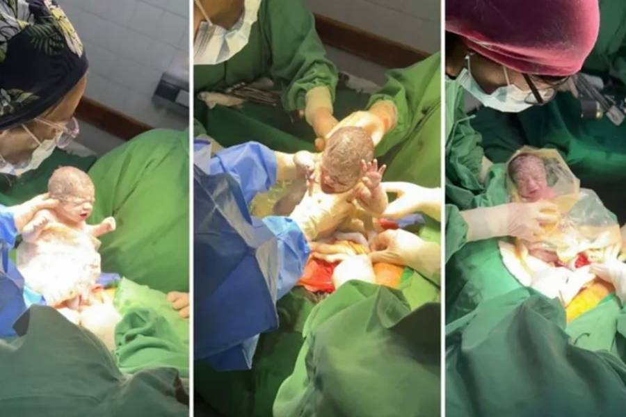 Un caso que sucede cada un millón: nacieron trigemelas en Salta