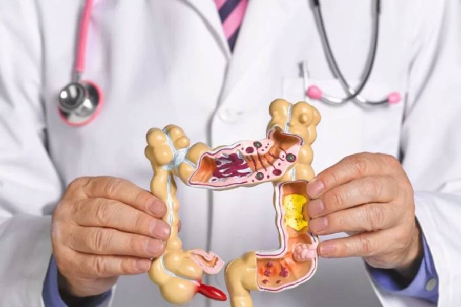 Una nueva droga demostró duplicar la sobrevida libre de progresión del cáncer de colon avanzado
