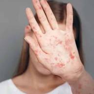 Alerta del Ministerio de Salud por posibles contagios de sarampión en distintos puntos del país