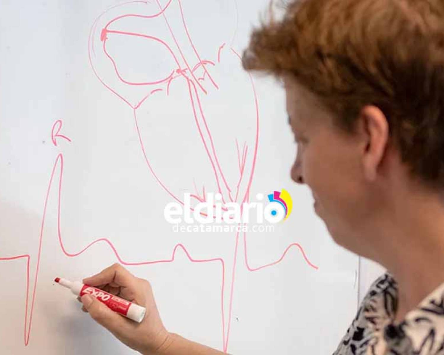 Importante hallazgo argentino permite el desarrollo de un marcapasos más avanzado