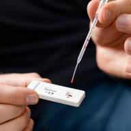 Fuerte aumento de una infección de transmisión sexual en Argentina: los casos presentan la mayor suba en cinco años