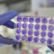 Argentinos hallan que dengue, Zika y fiebre amarilla se replican del mismo modo: se viene un antiviral