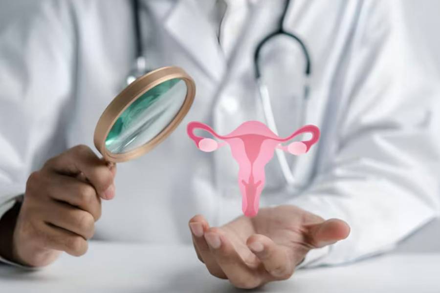 Tumores ginecológicos: se diagnostican 30 casos por día en Argentina