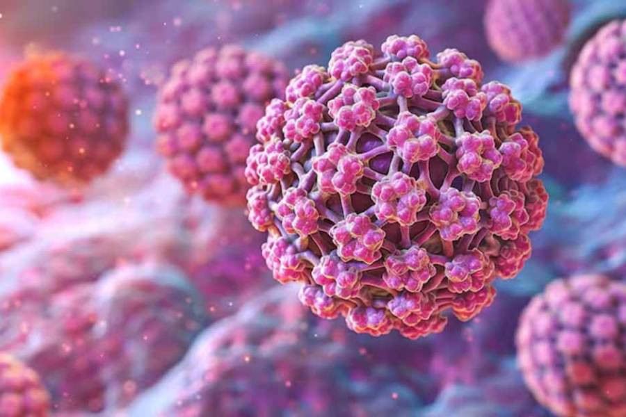 VPH: se estima que 8 de cada 10 personas lo contraerán alguna vez en su vida